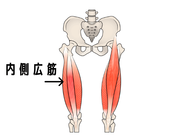 内側広筋